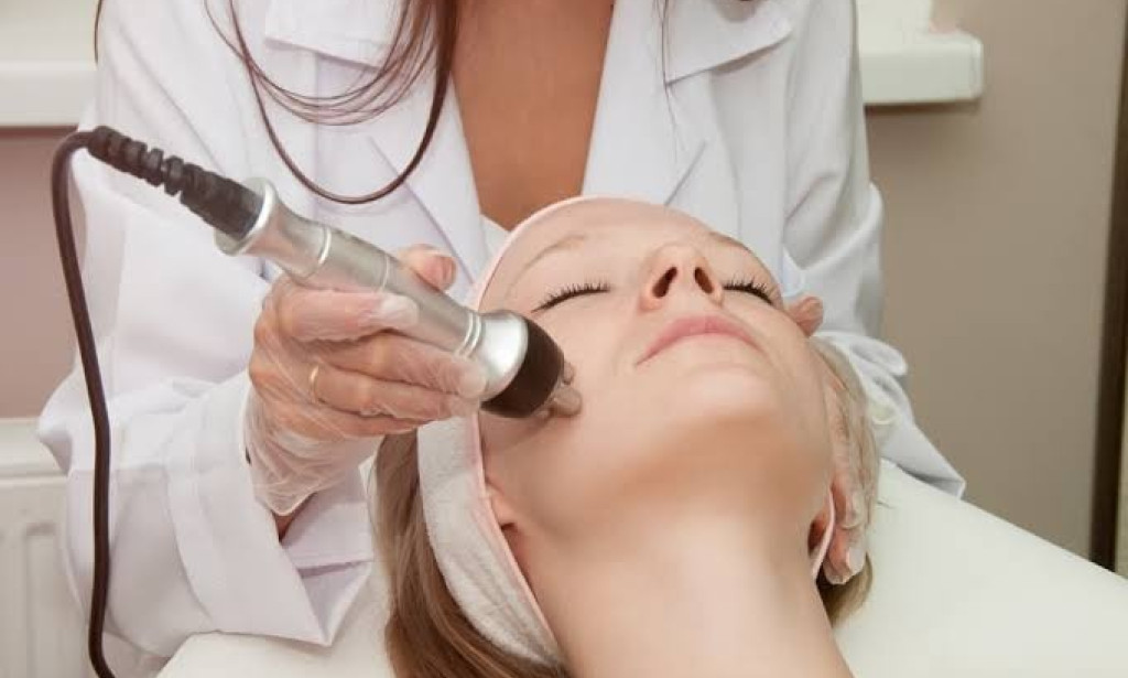 Top 10 Reasons to Choose Radio Frequency Treatment for Skin Tightening