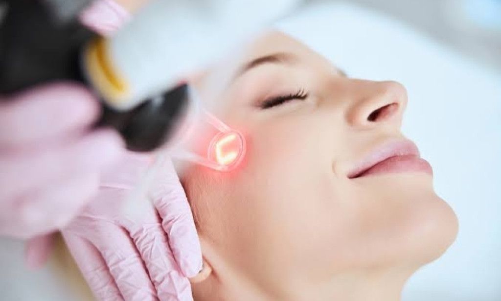 Top 10 Reasons to Choose Laser Skin Resurfacing for Acne Scars