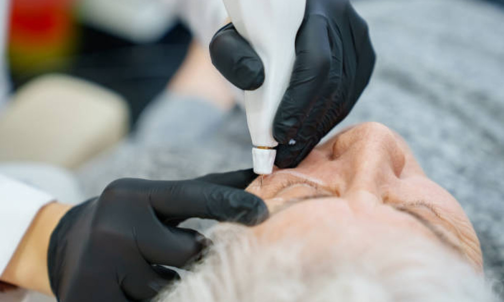 Top Plexr Plasma Eye Lift in Dubai: A Non-Surgical Solution for Brighter Eyes