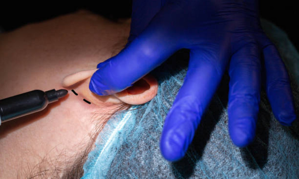 Top Ear Cosmetic Surgery in Dubai for Prominent Ears