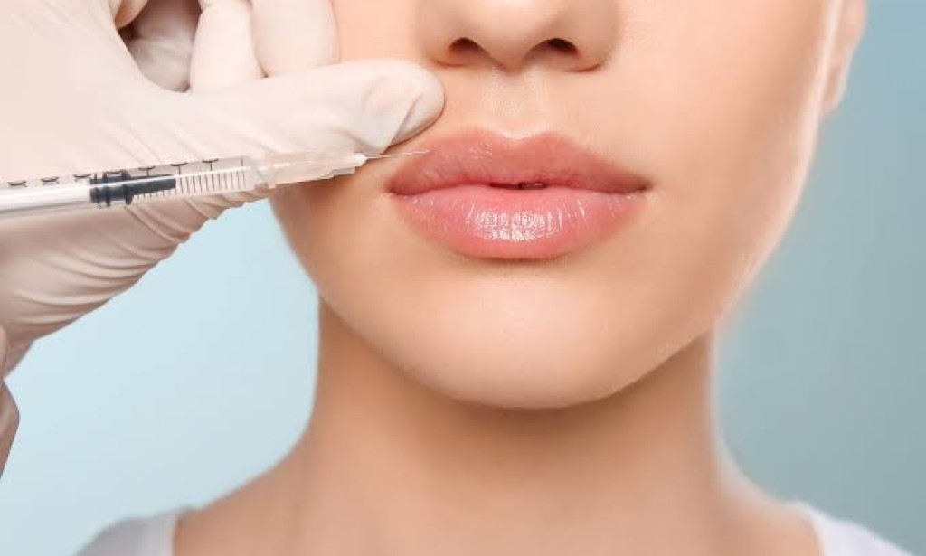 How Painful Are Lip Filler Injections for First-Timers?