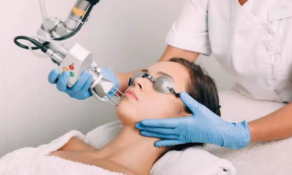 What Happens During Laser skin resurfacing?