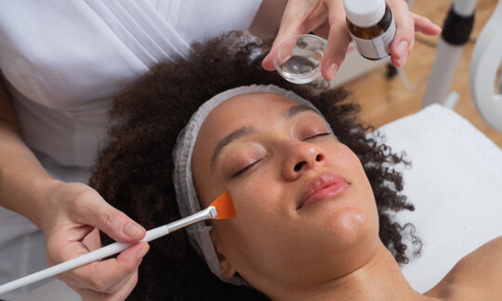 How Can Chemical Peel Treatment Help Reduce the Look of Large Pores?