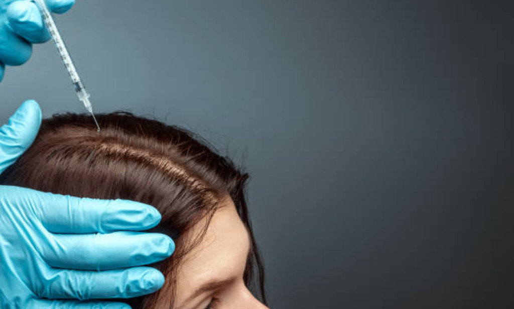 Exosome Hair Therapy in Dubai: How Expert Regrowth Guide Work