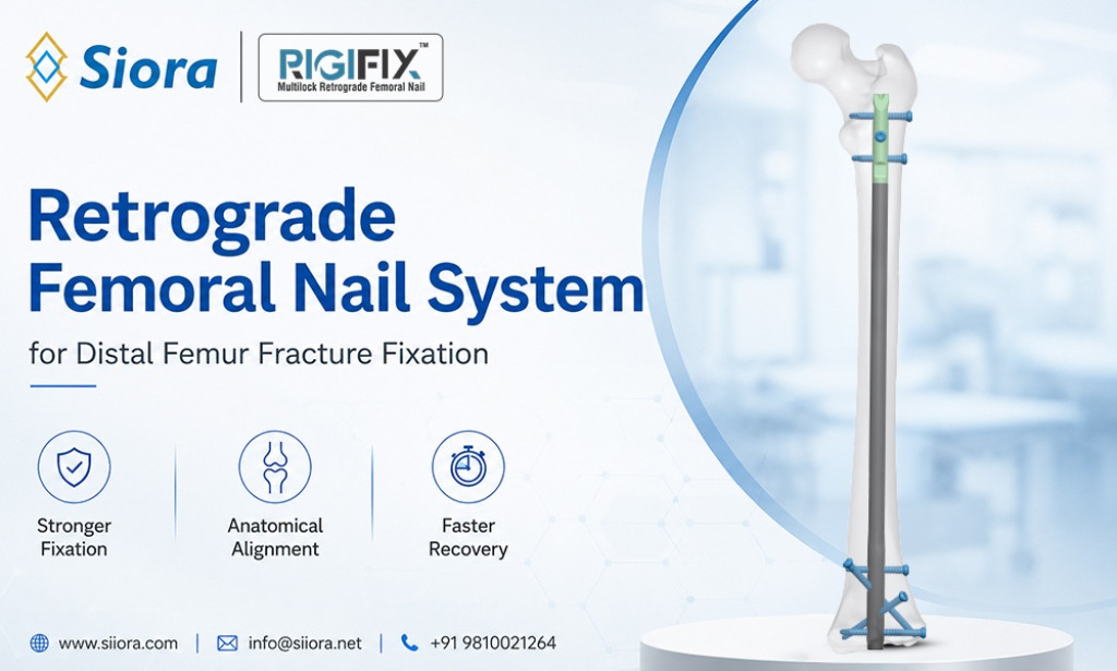 What Is a Retrograde Femoral Nail System for Distal Femur Fracture Fixation?